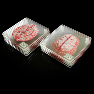 Brain Specimen Coasters home decor Set 3D Organ Brain Halloween Artwork Brain Slices Square Acrylic Drinks Table Coaster