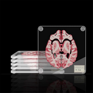 Brain Specimen Coasters home decor Set 3D Organ Brain Halloween Artwork Brain Slices Square Acrylic Drinks Table Coaster
